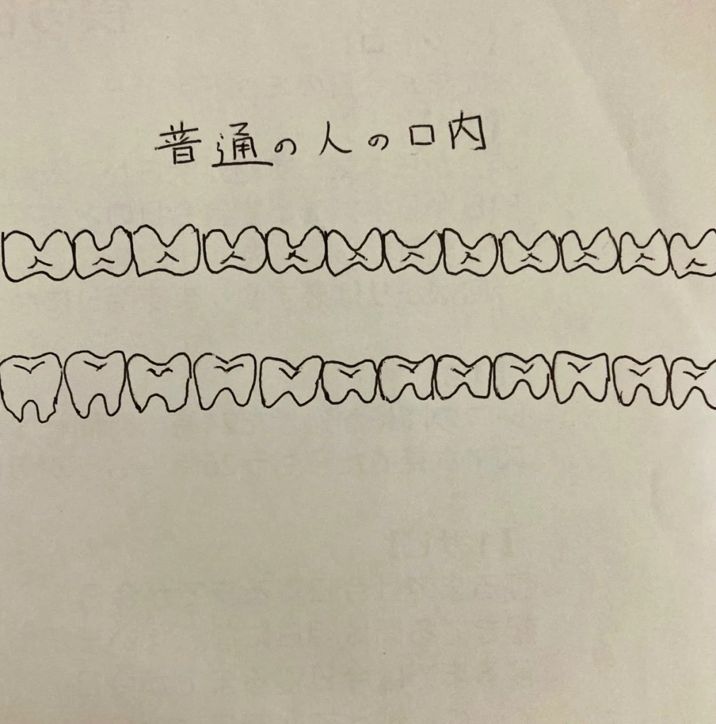 普通の人の口内平面図